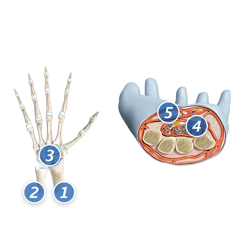 Graphic of the bones in the left hand and close up of the inner structure of the hand  Graphic of the bones in the left hand and close up of the inner structure of the hand
